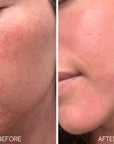 Lumiellé Glass Skin Liquid Exfoliant 4 oz