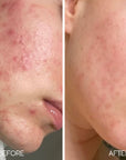 Lumiellé Glass Skin Liquid Exfoliant 4 oz