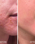 Lumiellé Glass Skin Liquid Exfoliant 4 oz