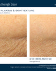 Skinbetter NEW! AlphaRet Body Overnight Cream