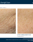Skinbetter NEW! AlphaRet Body Overnight Cream