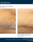 Skinbetter NEW! AlphaRet Body Overnight Cream