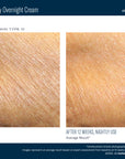 Skinbetter NEW! AlphaRet Body Overnight Cream
