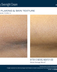 Skinbetter NEW! AlphaRet Body Overnight Cream
