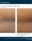 Skinbetter NEW! AlphaRet Body Overnight Cream