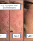 Renée Rouleau Skin Recovery Lotion