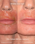 NEW Pavise Extracellular Matrix Restore