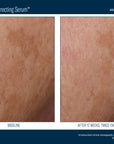 Skinbetter Even Tone Correcting Serum 50 ml