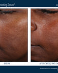 Skinbetter Even Tone Correcting Serum 50 ml