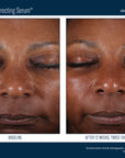 Skinbetter Even Tone Correcting Serum 50 ml