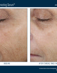 Skinbetter Even Tone Correcting Serum 50 ml