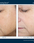 Skinbetter Even Tone Correcting Serum 50 ml