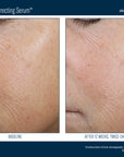 Skinbetter Even Tone Correcting Serum 50 ml