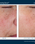 Skinbetter Even Tone Correcting Serum 50 ml