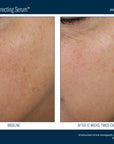 Skinbetter Even Tone Correcting Serum 50 ml