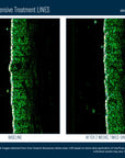 Skinbetter InterFuse Intensive Treatment LINES