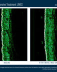 Skinbetter InterFuse Intensive Treatment LINES