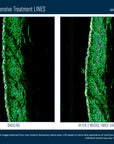 Skinbetter InterFuse Intensive Treatment LINES