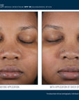 Skinbetter sunbetter SHEER SPF 56 Sunscreen Stick