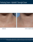 Skinbetter Techno Neck Perfecting Cream
