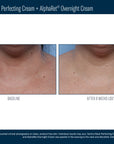 Skinbetter Techno Neck Perfecting Cream