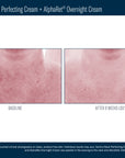 Skinbetter Techno Neck Perfecting Cream