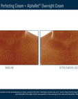 Skinbetter Techno Neck Perfecting Cream