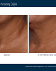 Skinbetter Techno Neck Perfecting Cream