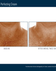 Skinbetter Techno Neck Perfecting Cream