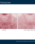 Skinbetter Techno Neck Perfecting Cream
