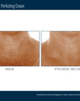 Skinbetter Techno Neck Perfecting Cream