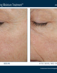 Skinbetter Trio Rebalancing Moisture Treatment