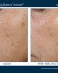 Skinbetter Trio Rebalancing Moisture Treatment