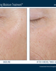 Skinbetter Trio Rebalancing Moisture Treatment