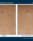 Skinbetter Trio Rebalancing Moisture Treatment