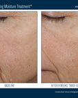 Skinbetter Trio Rebalancing Moisture Treatment