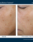 Skinbetter Trio Rebalancing Moisture Treatment