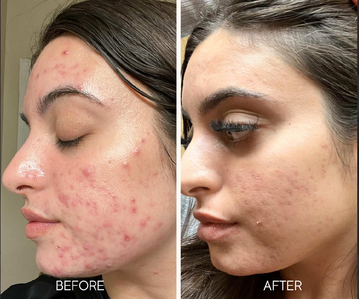 Lumiellé Glass Skin Liquid Exfoliant 4 oz