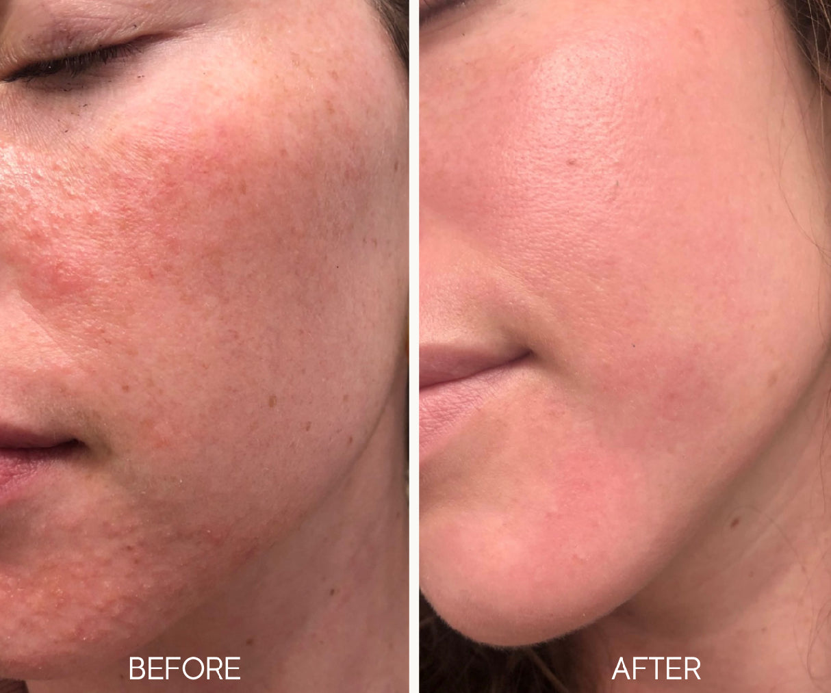 Lumiellé Glass Skin Liquid Exfoliant 4 oz