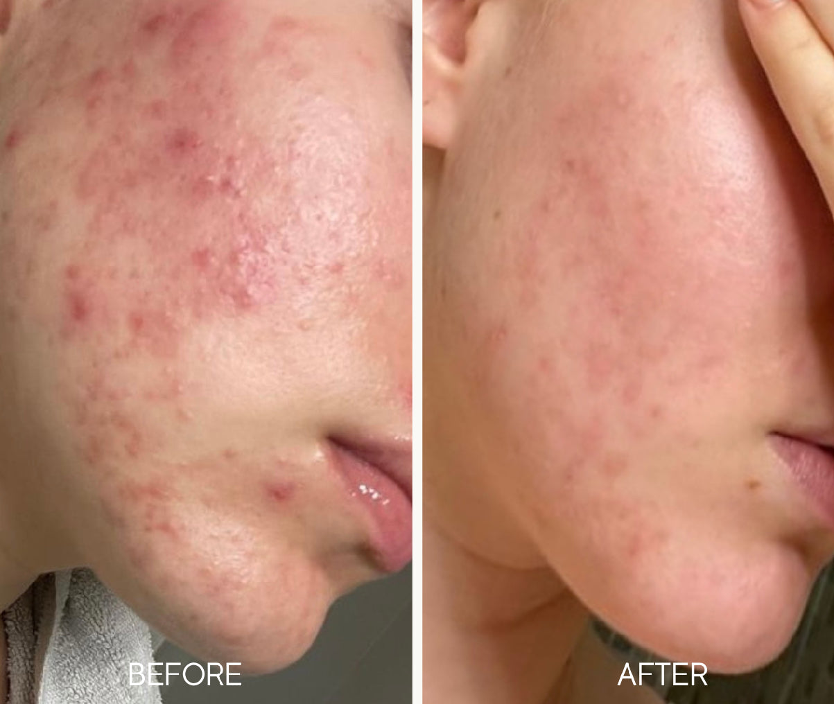 Lumiellé Glass Skin Liquid Exfoliant 4 oz
