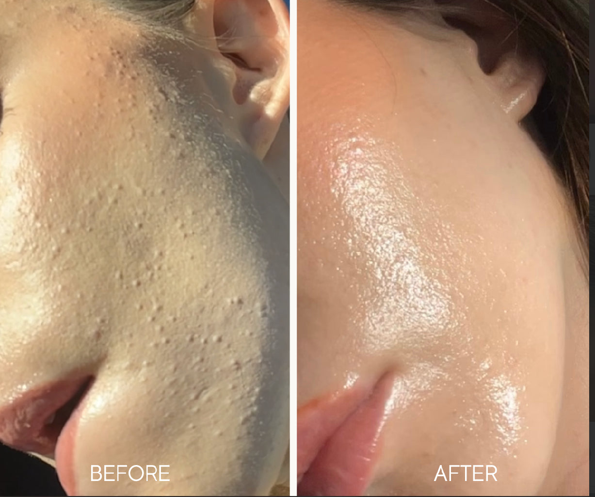 Lumiellé Glass Skin Liquid Exfoliant 4 oz