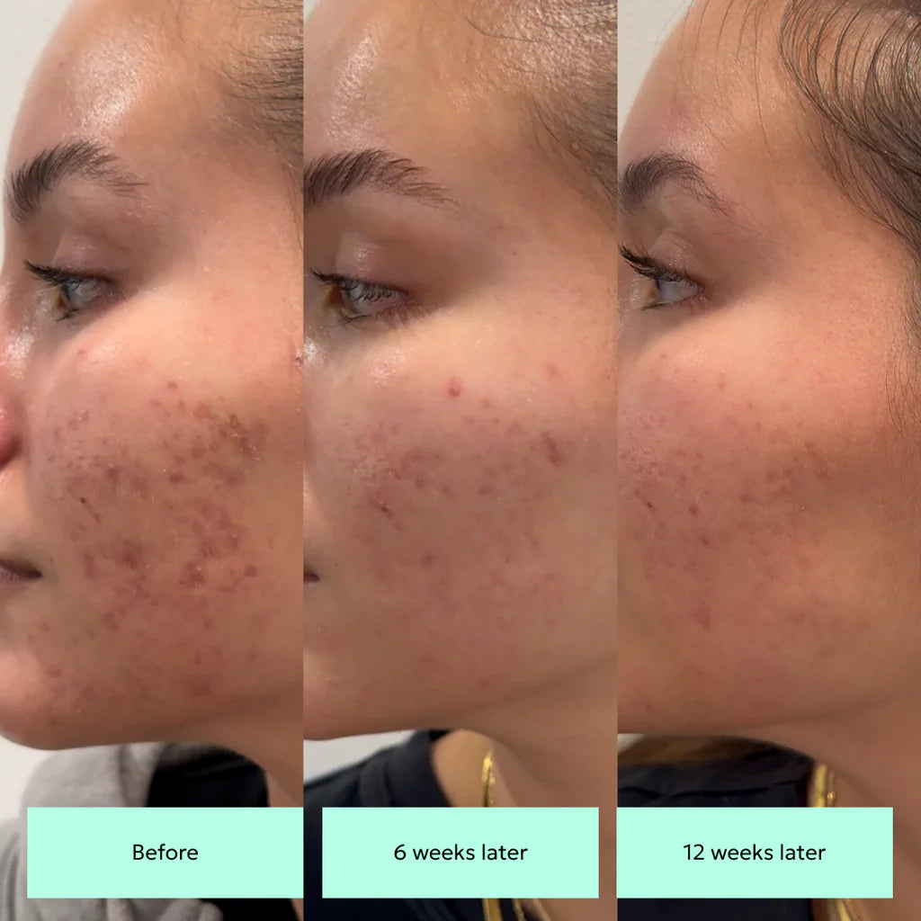 Renée Rouleau HyperFix Fading Toner