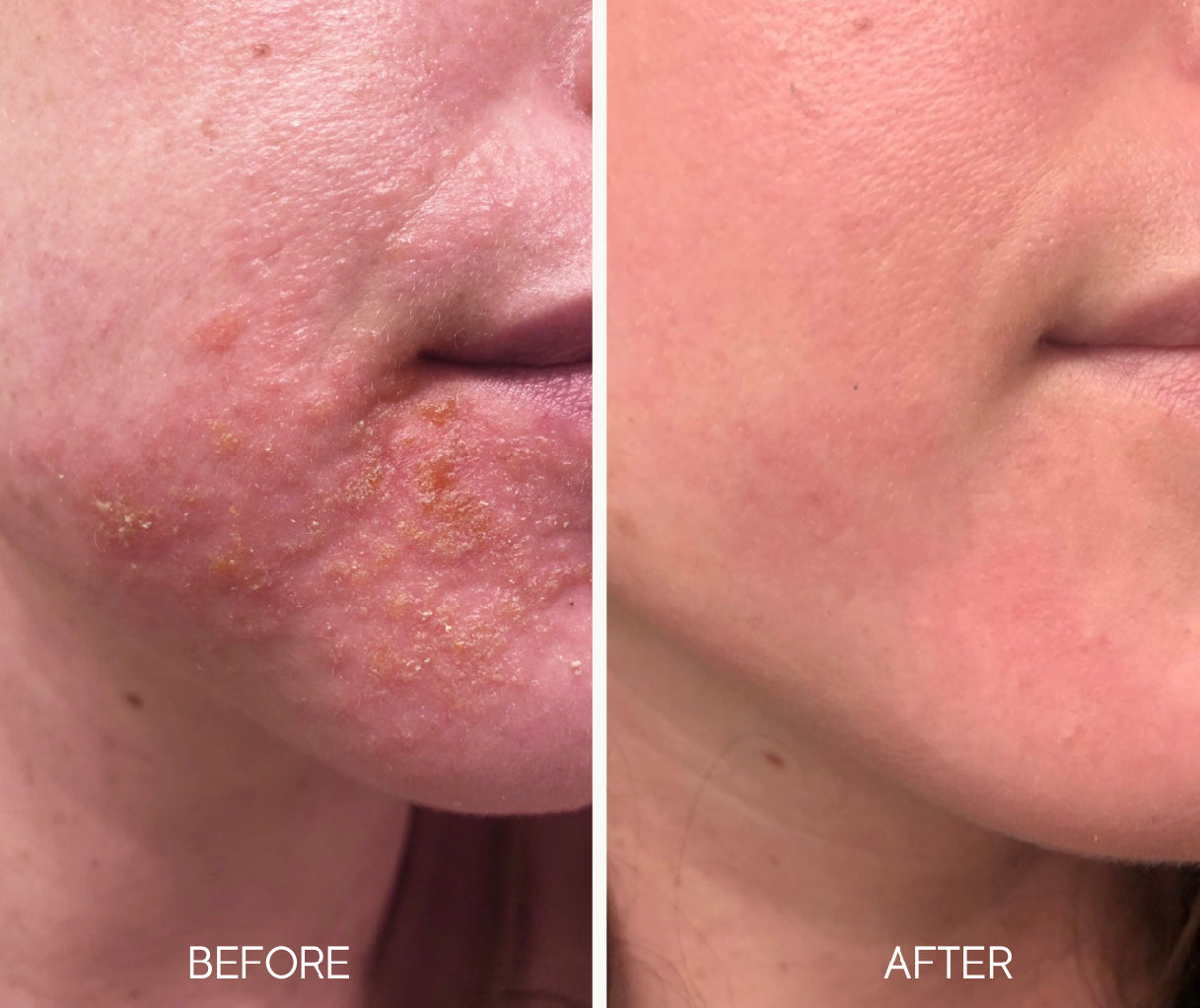 Lumiellé Glass Skin Liquid Exfoliant 4 oz