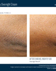 Skinbetter NEW! AlphaRet Body Overnight Cream