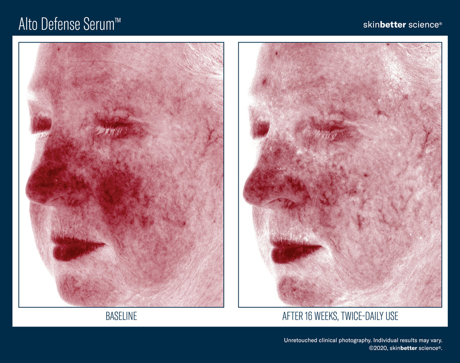 Skinbetter Alto Defense Serum