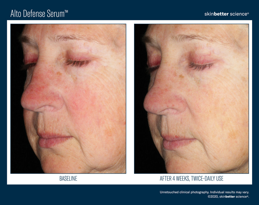 Skinbetter Alto Defense Serum