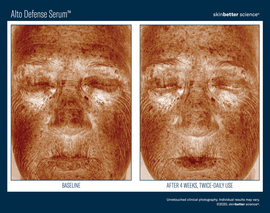 Skinbetter Alto Defense Serum