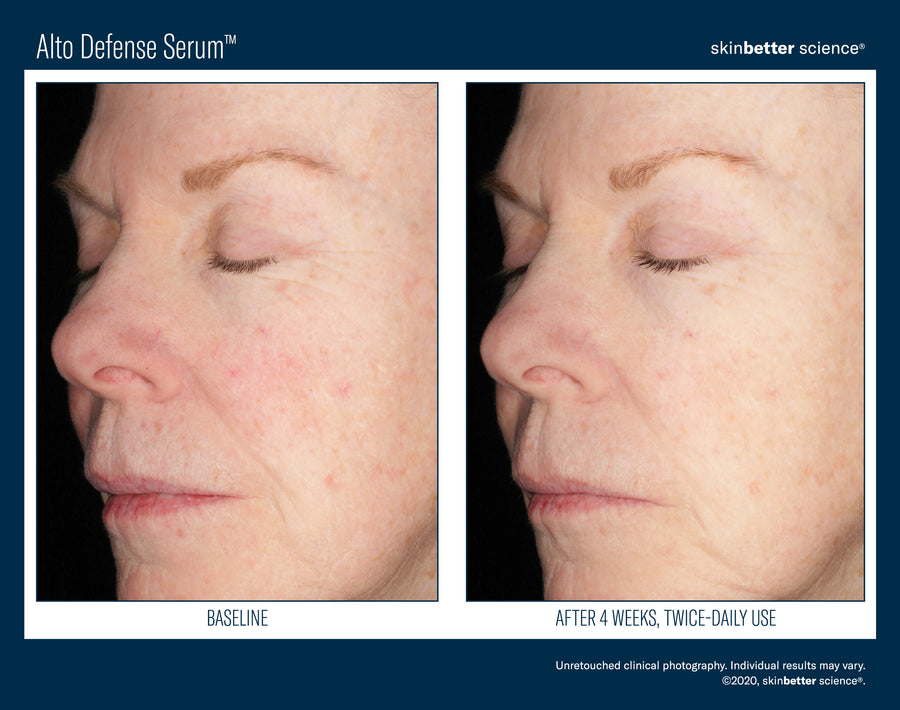 Skinbetter Alto Defense Serum