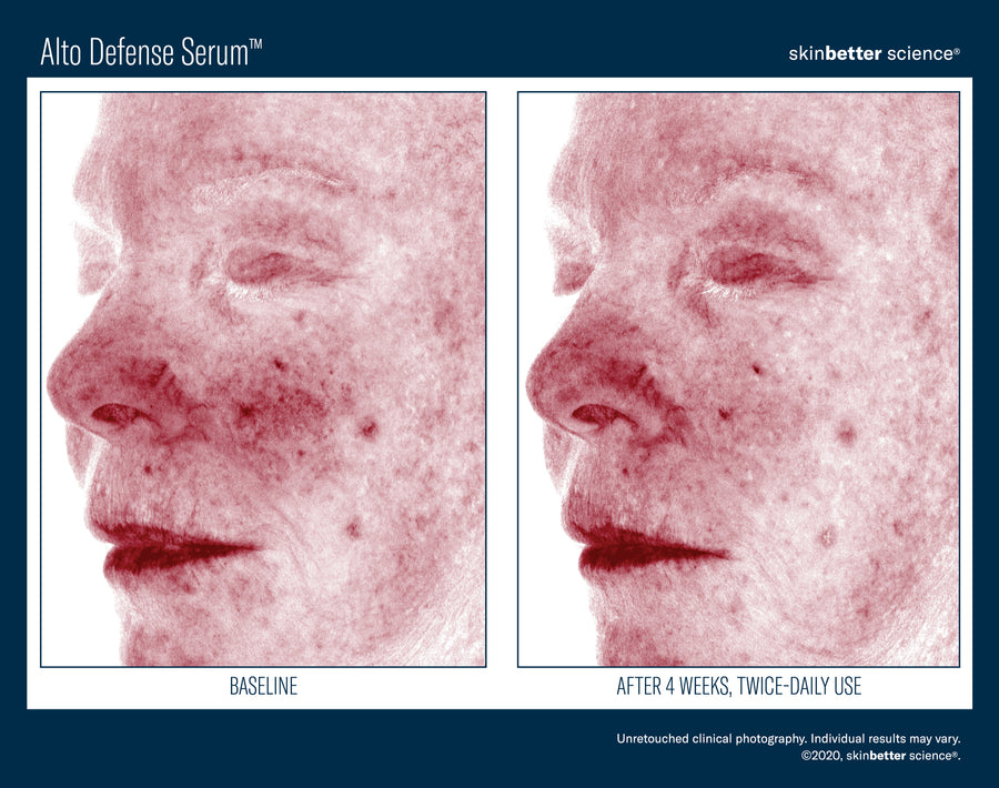 Skinbetter Alto Defense Serum