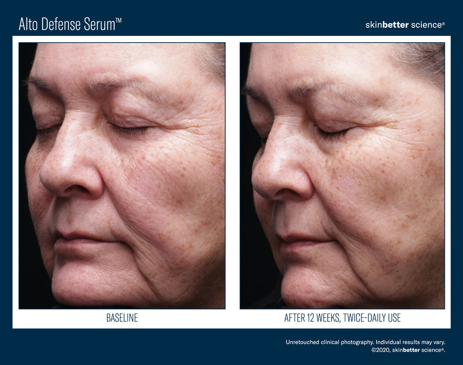 Skinbetter Alto Defense Serum